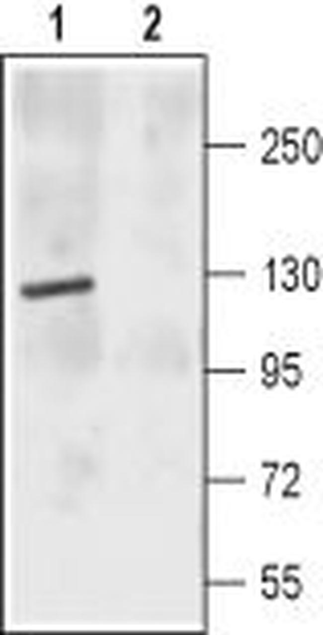NMDAR2C (GRIN2C) (EXTRACELLULA