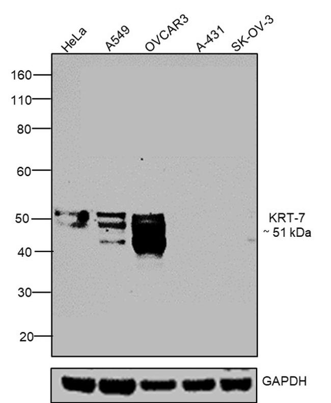 ANTI-HI CYTOKERATIN 7 LP5K PUR