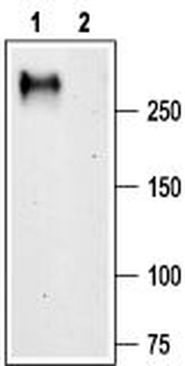 CACNA1G (CAV3.1) ANTIBODY