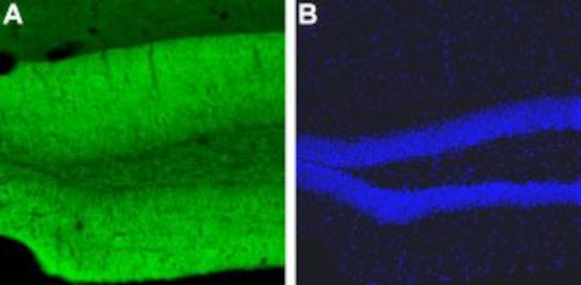 CAV1.2 (CACNA1C) ANTIBODY