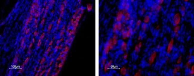 CAV3.2 (CACNA1H) ANTIBODY