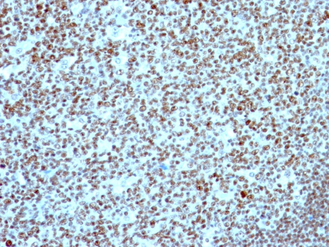 NUCLEOLIN