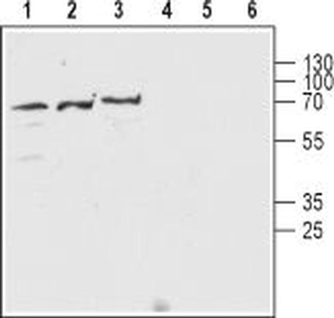 NICOTINIC ACETYLCHOLINE RECEPT
