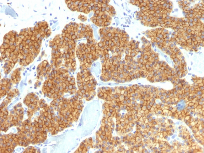 PARATHYROID HORMONE (PTH) (N-T