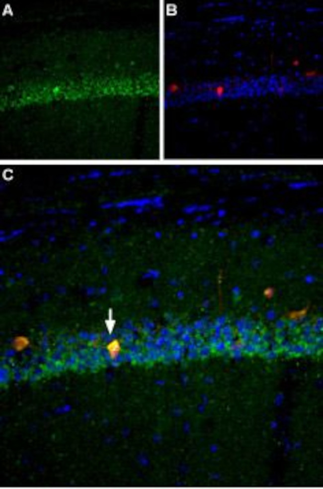 NAV1.6 (SCN8A) ANTIBODY
