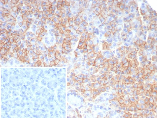 CD99/MIC2 (EWING‘S SARCOMA MAR
