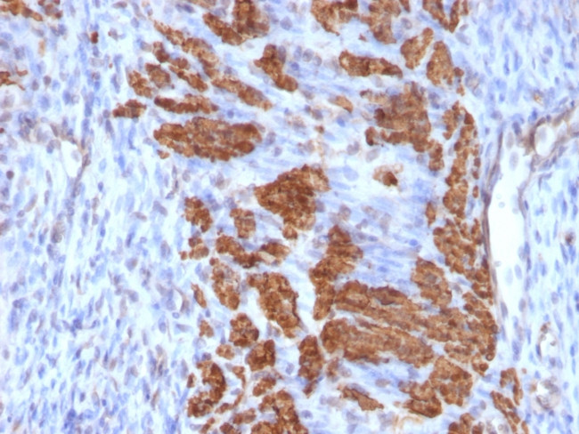 CALPONIN-1 (SMOOTH MUSCLE MARK