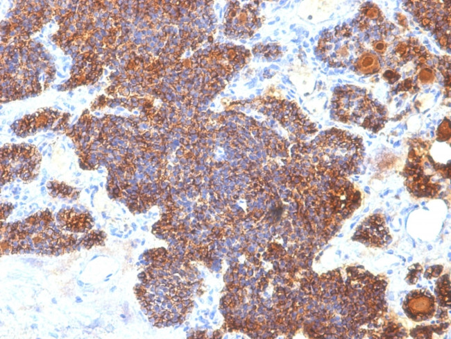 PARATHYROID HORMONE (PTH) (C-T