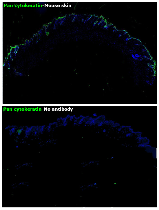 ANTI-PAN CYTOKERATIN AF488 MAB