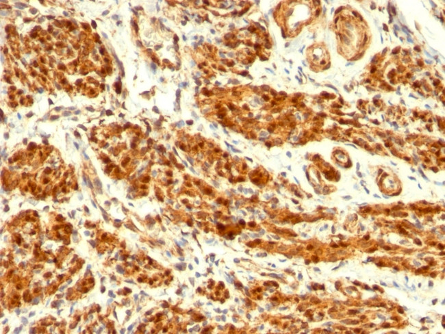 CALPONIN-1 (SMOOTH MUSCLE MARK