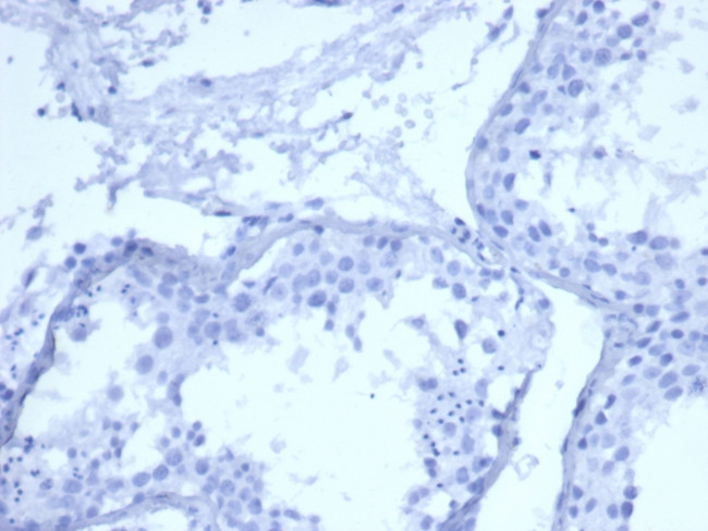 CYTOKERATIN 5 (KRT5)