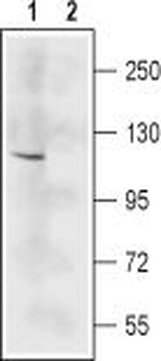 NMDAR2C (GRIN2C) (EXTRACELLULA