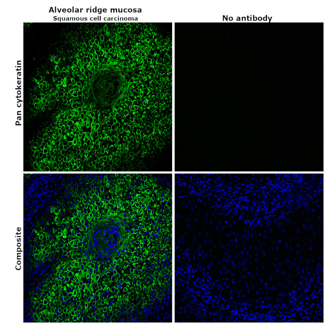 ANTI-PAN CYTOKERATIN AF488 MAB