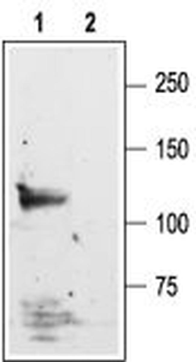 NMDAR1 (GLUN1) (EXTRACELLULAR)