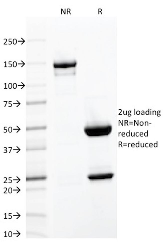 CD103- INTEGRIN E7