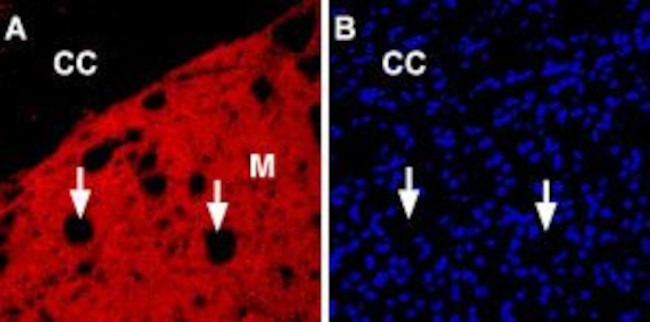 NICOTINIC ACETYLCHOLINE RECEPT