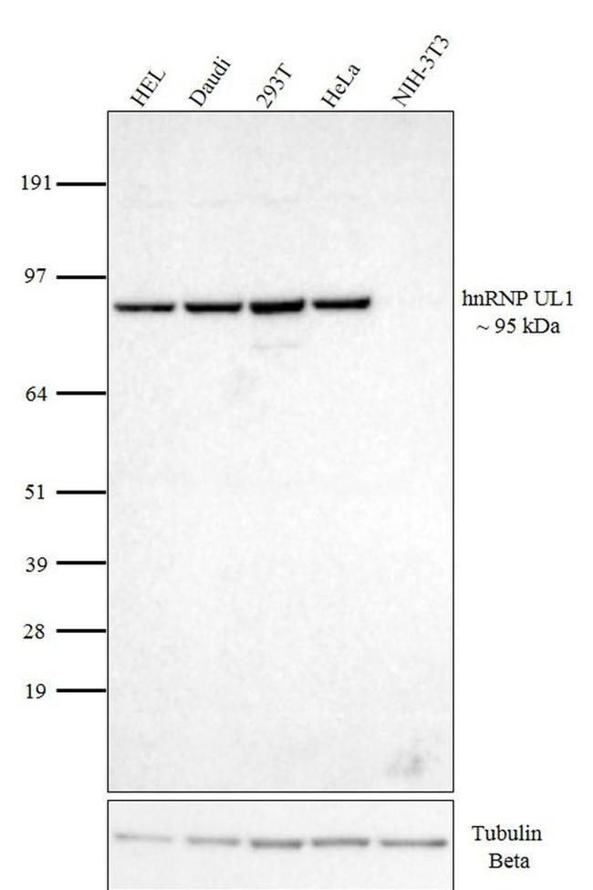 ANTI-HU HNRNP UL1 EAP 4A11 PUR