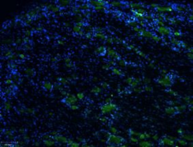 TRPV1 (VR1) (EXTRACELLULAR) AN
