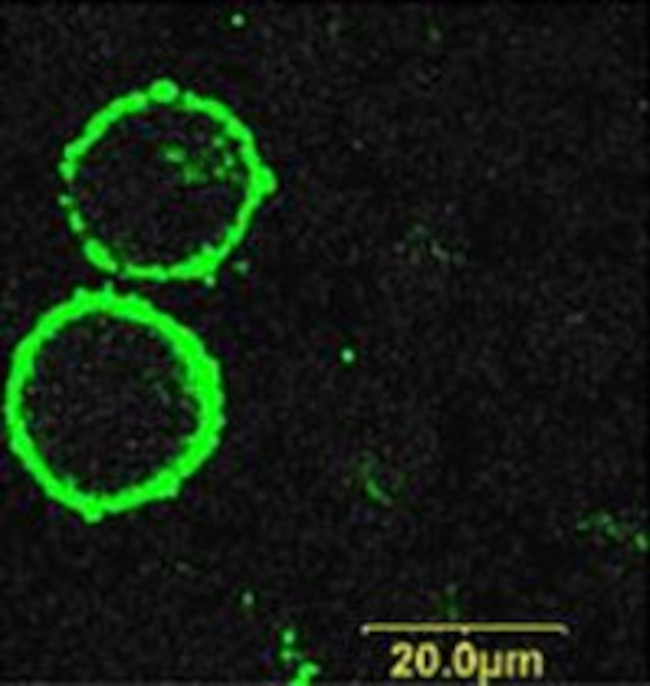 P2X7 RECEPTOR (EXTRACELLULAR)