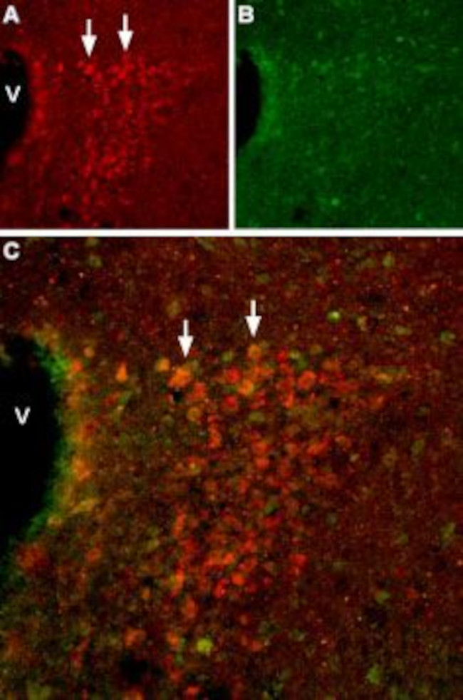 HCN2 ANTIBODY