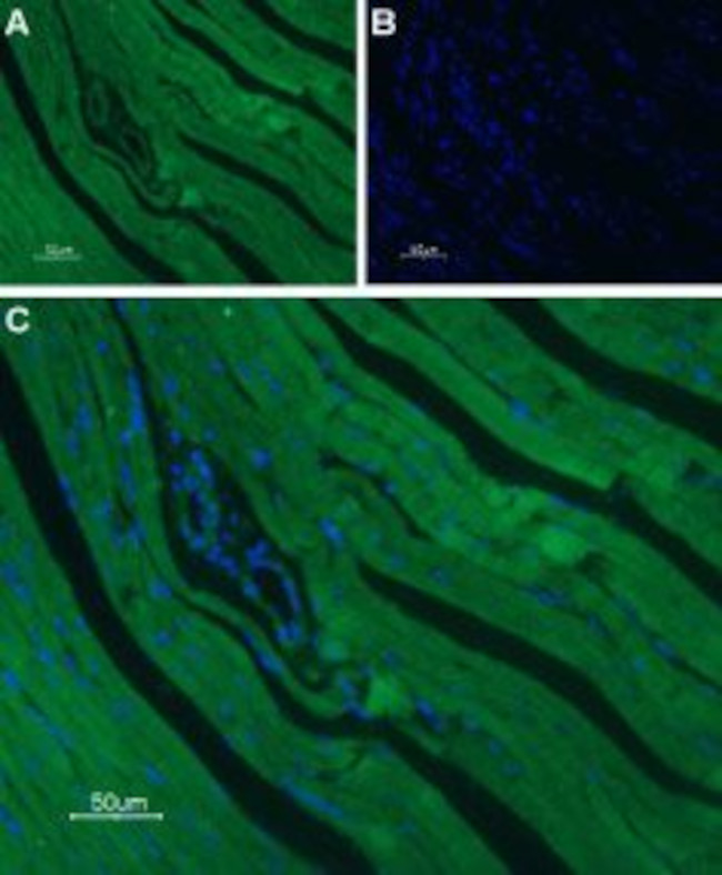 CAV1.2 (CACNA1C) ANTIBODY