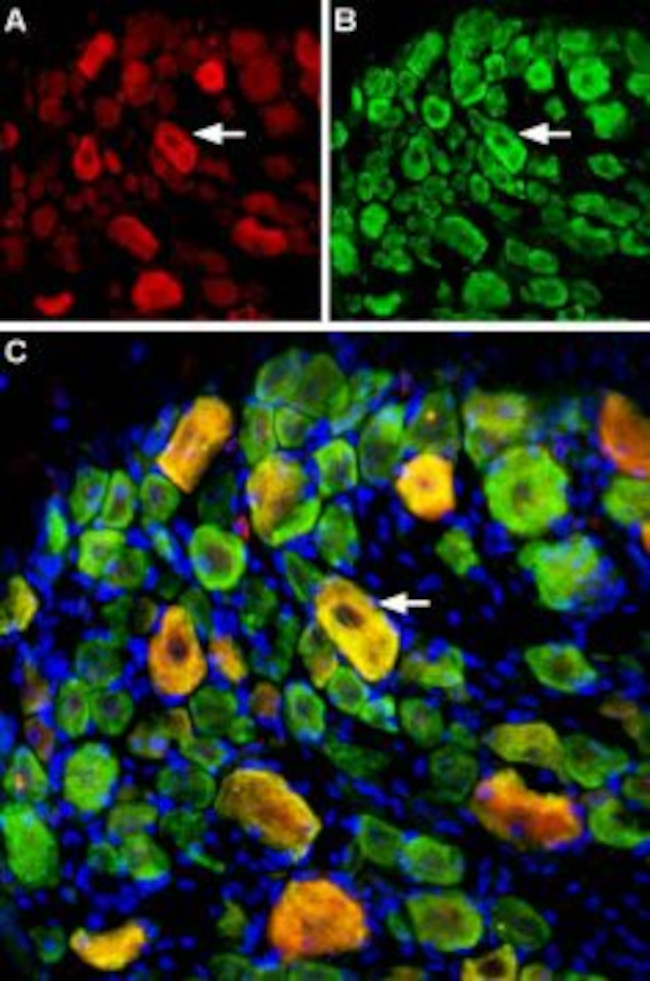 ASIC3 ANTIBODY