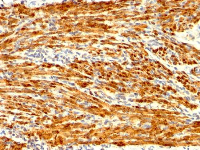 CALPONIN-1