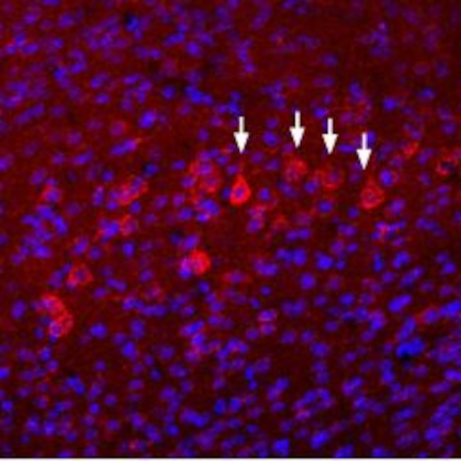 NMDAR3B (GRIN3B) (EXTRACELLULA