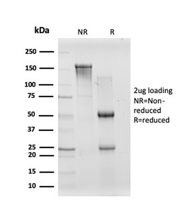 CREB5- CRE-BPA