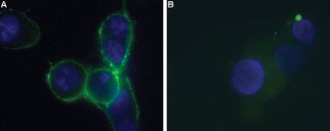 P2X7 RECEPTOR (EXTRACELLULAR)