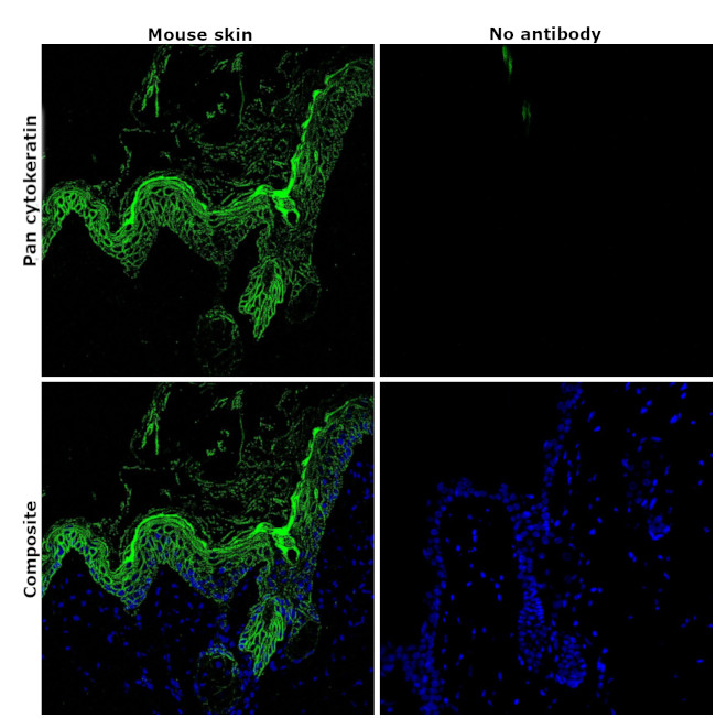 ANTI-PAN CYTOKERATIN AF488 MAB