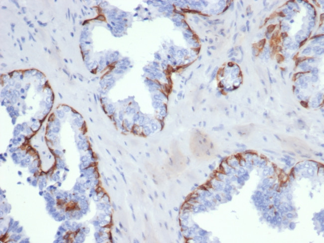 CYTOKERATIN 5 (KRT5)