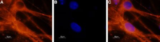 NAV1.6 (SCN8A) ANTIBODY