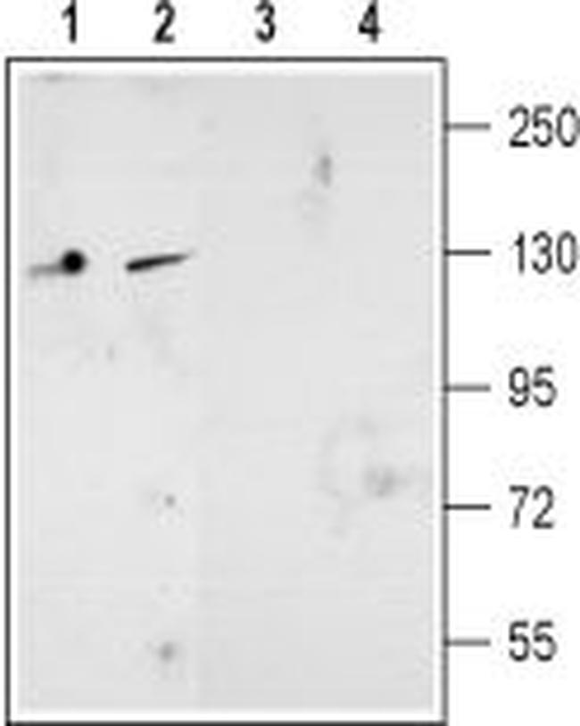NMDAR2D (GRIN2D) (EXTRACELLULA