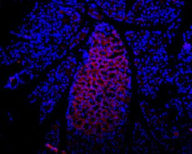 P2X7 RECEPTOR (EXTRACELLULAR)