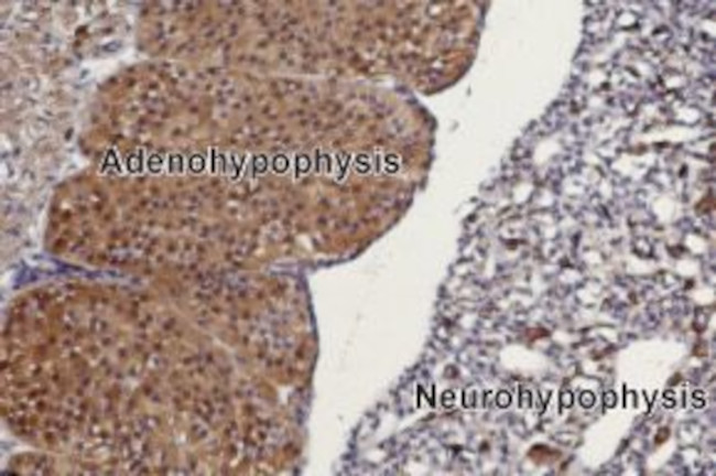 TRPC3 ANTIBODY