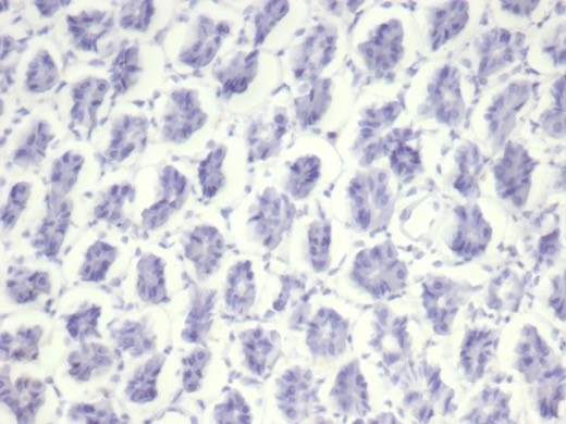 NUCLEOLIN (MARKER OF HUMAN CEL