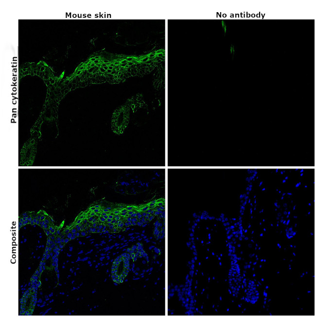 ANTI-PAN CYTOKERATIN AF488 MAB