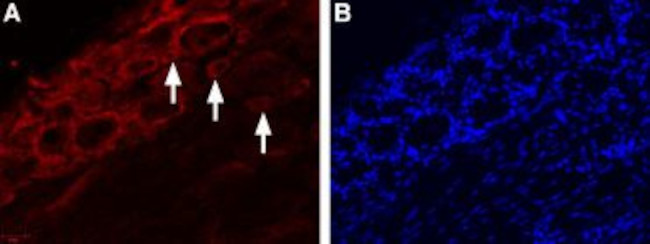 TRPV4 ANTIBODY ATTO 550