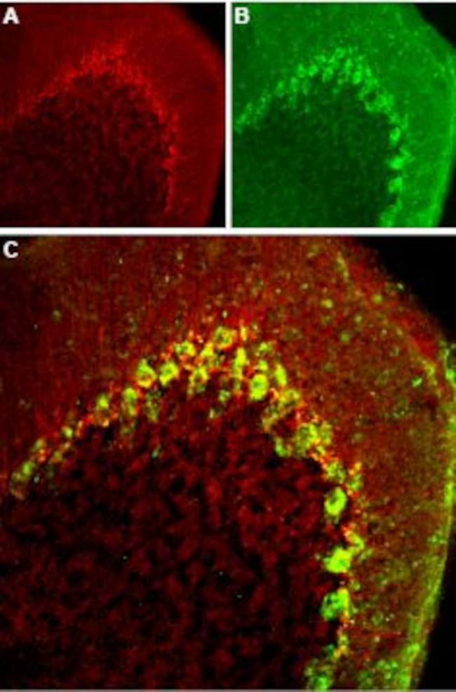 CAV3.2 (CACNA1H) ANTIBODY