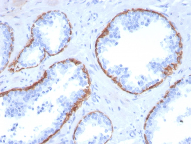CYTOKERATIN 5 (KRT5)
