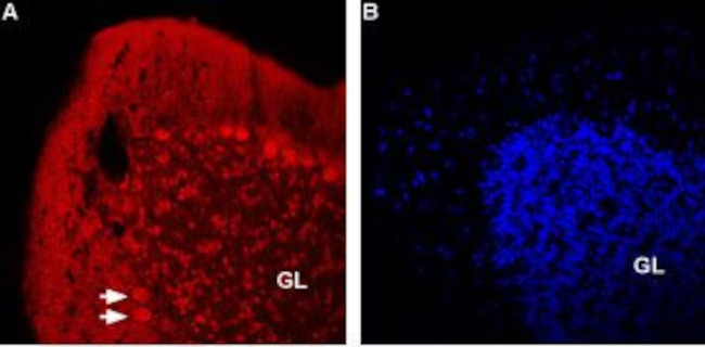 NICOTINIC ACETYLCHOLINE RECEPT