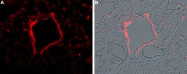TRPM2 ANTIBODY ATTO 594