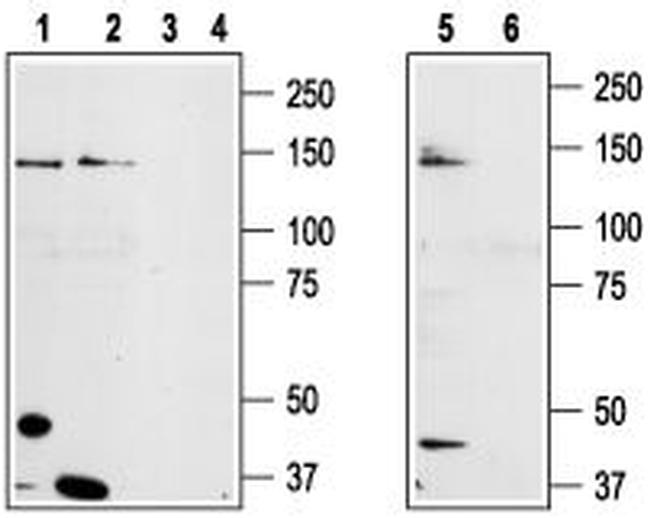 TRPM8 (EXTRACELLULAR) ANTIBODY