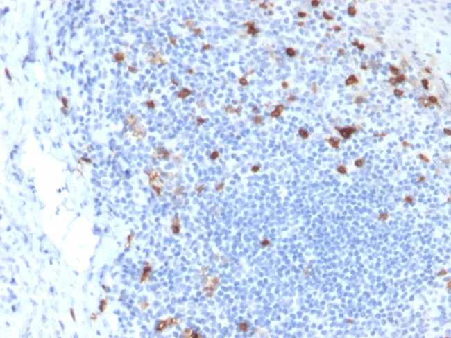 CD103- INTEGRIN E7