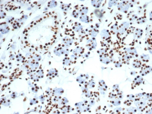 NUCLEOLIN (MARKER OF HUMAN CEL