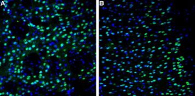 NMDAR2A (GLUN2A) (EXTRACELLULA