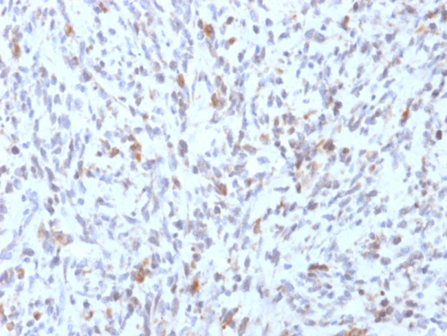 MYOD1