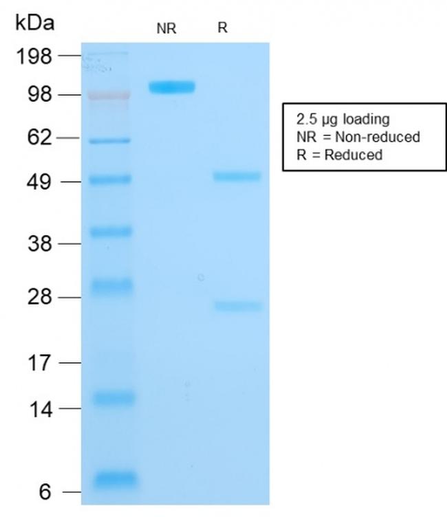 CYTOKERATIN 16 (KRT16)