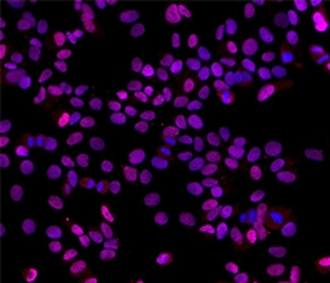 ESTROGEN RECEPTOR ALPHA ANTIBO